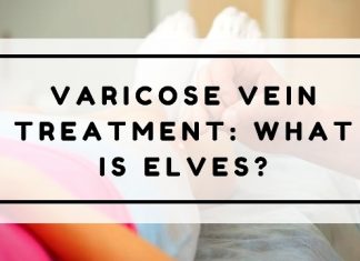 Varicose Vein Treatment