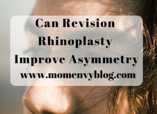 Can revision rhinoplasty improve asymmetry