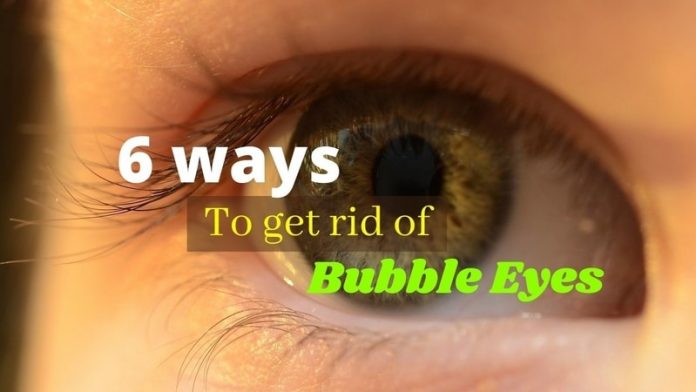 Eye bubbles